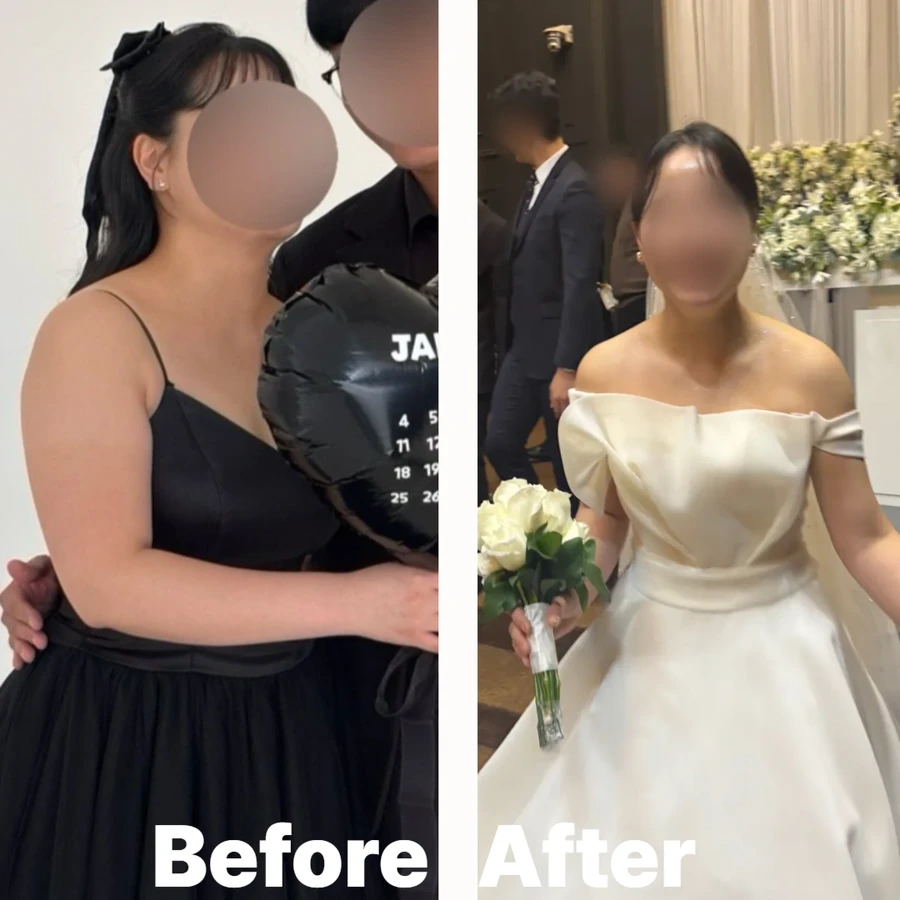 여수 결혼전관리 웨딩 관리 비포애프터 결과 5 - 웨디아 여수웅천점